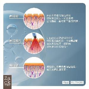 BTL Ultra360膠原緊緻療程-體驗價