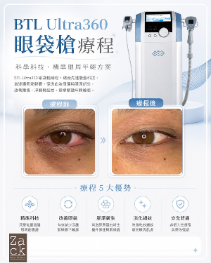 BTL Ultra360 眼部逆齡療程-體驗價