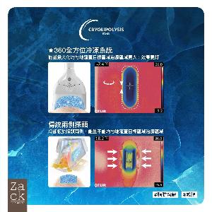 Cryolipolysis 冰感定位纖脂療程(1格)-體驗價